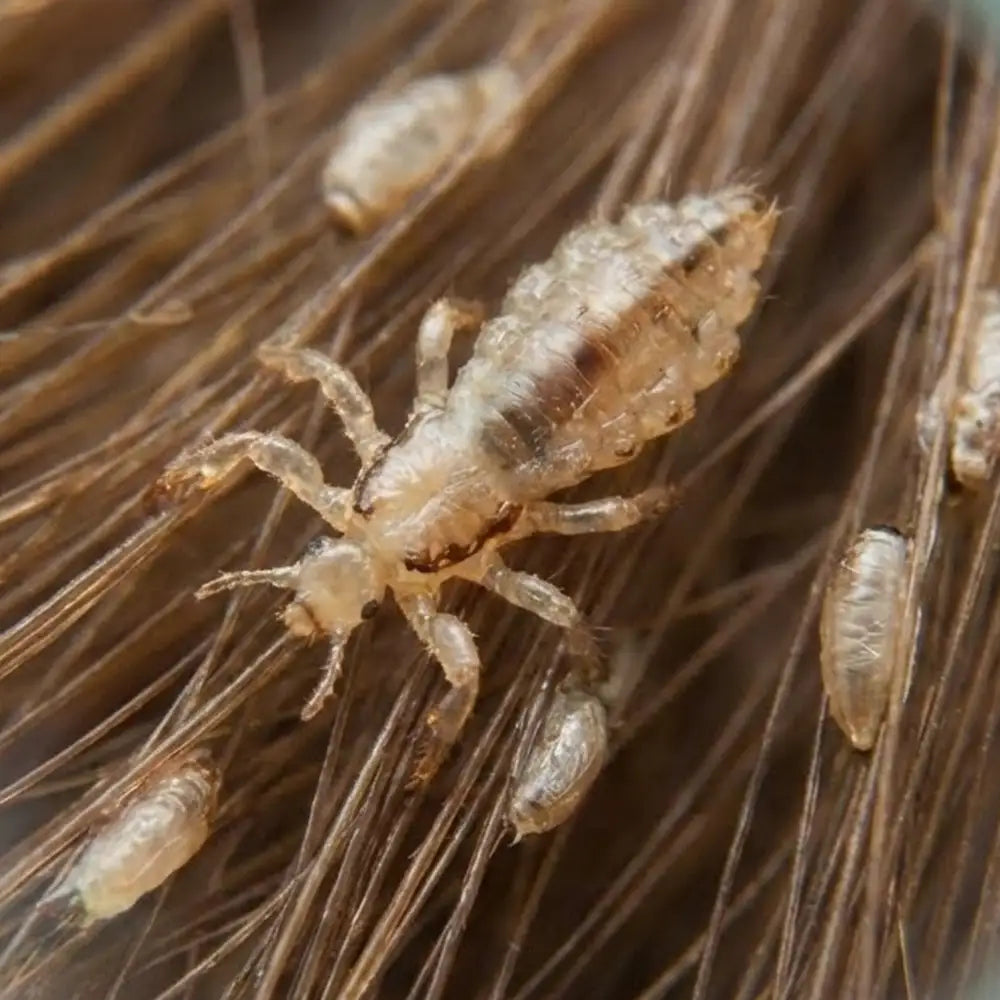 Zoom de poux visibles sur des cheveux